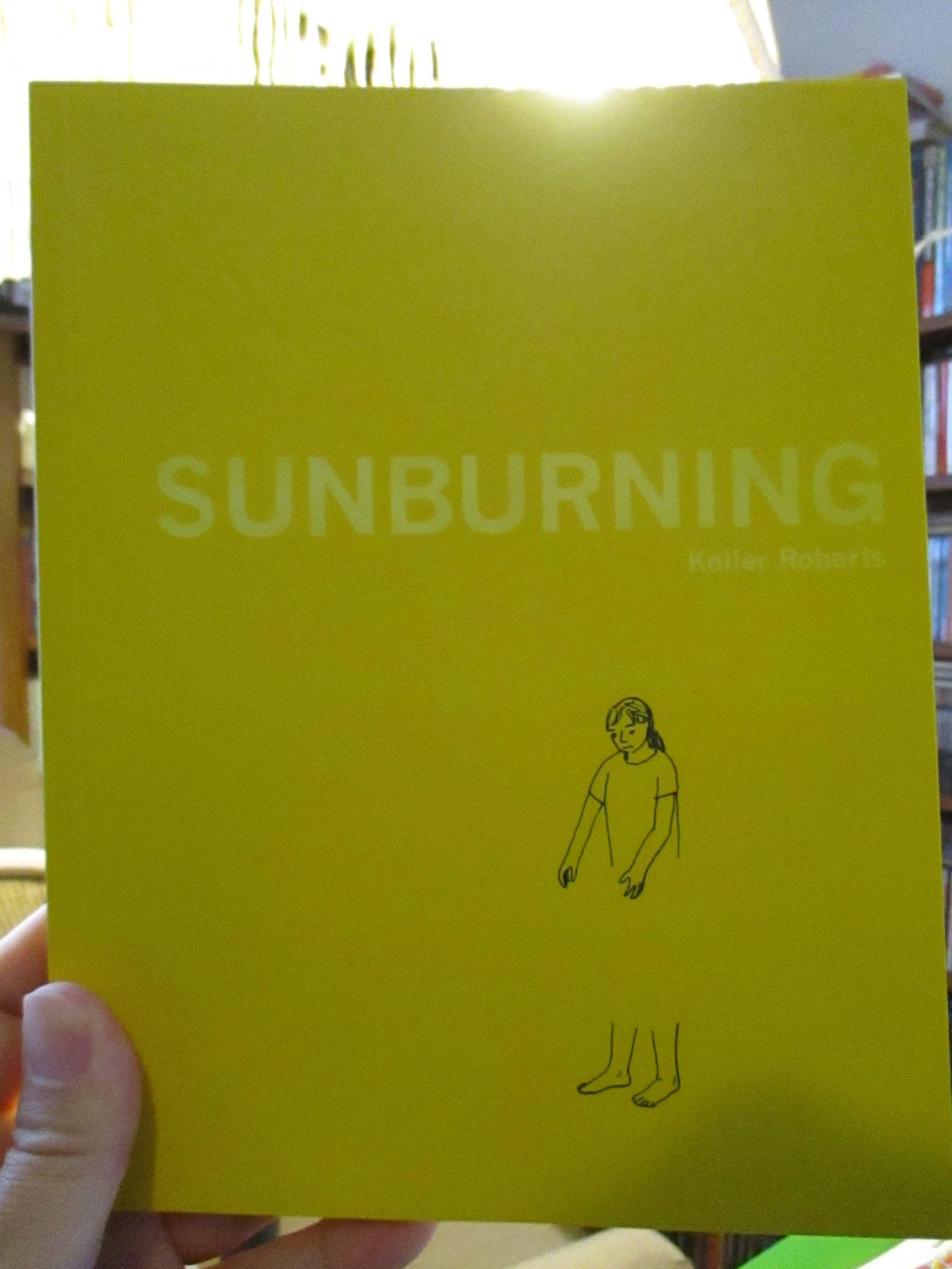 SUNBURNING by Keiler Roberts